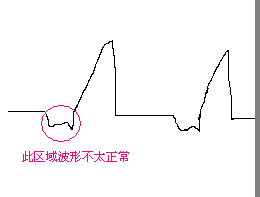 QQ截图调试的异常波形.png